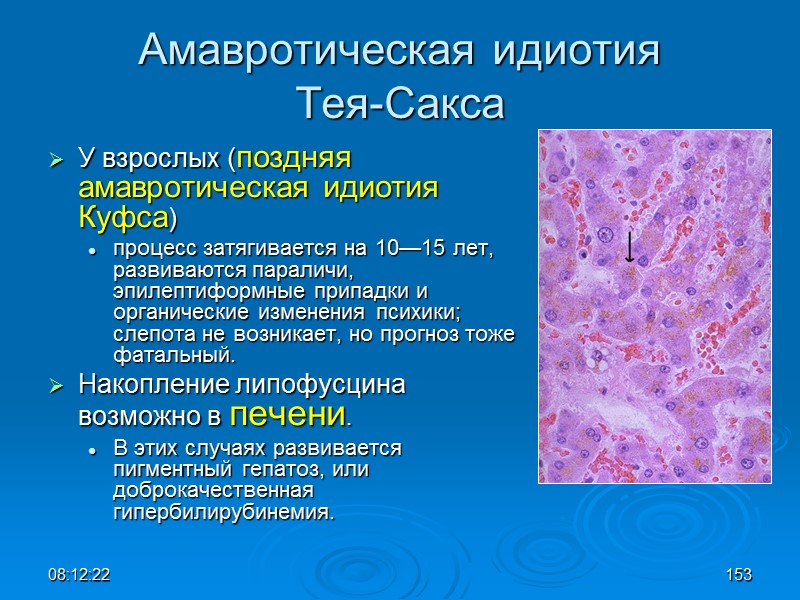 08:12:02 153 Амавротическая идиотия  Тея-Сакса У взрослых (поздняя амавротическая идиотия Куфса)  процесс